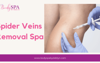 spider veins removal